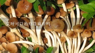 艾叶可以治疗荨麻疹吗