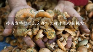 掉头发特严重怎么办？怎样才能控制掉发？