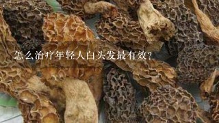 怎么治疗年轻人白头发最有效？