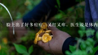 脸上出了好多痘痘，又红又痒，医生说是体内湿气太重，请问湿气太重的人吃什么食物可以祛除体内湿气？