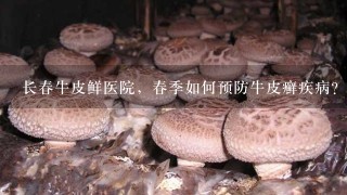 长春牛皮鲜医院，春季如何预防牛皮癣疾病？