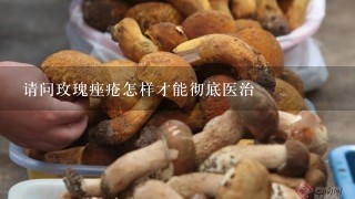 请问玫瑰痤疮怎样才能彻底医治